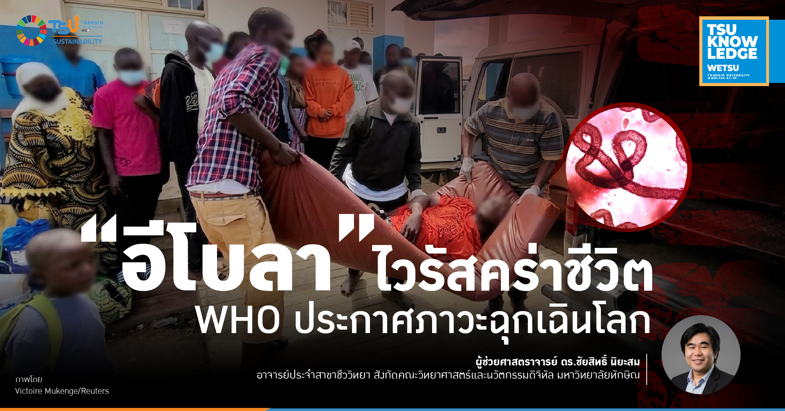 อีโบลา ไวรัสคร่าชีวิต WHO ประกาศภาวะฉุกเฉินโลก